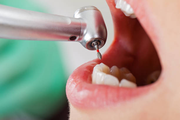 Tooth Infection Emergency Dentist in WI